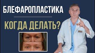 БЛЕФАРОПЛАСТИКА  КОГДА НУЖНО ДЕЛАТЬ, А КОГДА СТОИТ ПОДОЖДАТЬ?