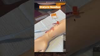 Mastering Dialysis - Learn How To Insert Needles For AV Fistula!