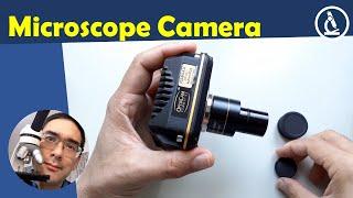   USB Microscope Camera review | Amateur Microscopy