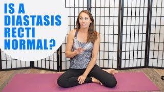 Is a Diastasis Recti Normal?