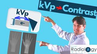 kVp and x-ray Contrast (Guide for Radiologic Technologists)