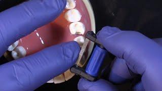 FitStrip Subgingival Finishing Strips from Garrison Dental Solutions