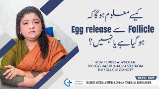 Understanding Ovulation to know when the Egg release from Folicle | Dr Naila Jabeen | Gynae Solution