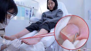 ASMR | The Most Professional Korean Pedicure | Foot Nail Art | Callus Removal