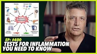 Ep:400 TESTS FOR INFLAMMATION YOU NEED TO KNOW