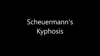 Scheuermann's Kyphosis Surgery