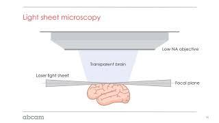 Tissue clearing tips: imaging (4/4)