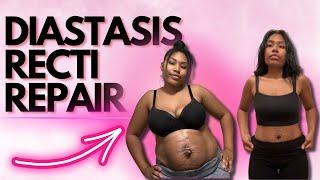 Top 3 Core Exercises to Heal Diastasis Recti Fast