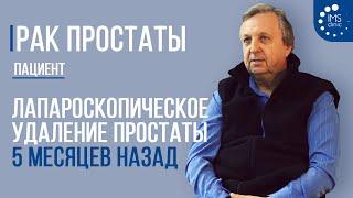 Рак простаты. Лапароскопическое удаление простаты 5 месяцев назад