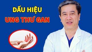 Dấu hiệu trên tay, chân cảnh báo ung thư gan Sống Khỏe