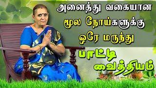 அனைத்து வகையான மூல நோய்களுக்கு ஒரே மருந்து | permanent cure of piles | மூல நோய் | Hemorrhoids