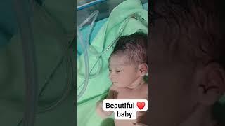 Hospitals and Health...FollowNewborn baby crying#viralreels #reelsviralfb #reelsforyou#zaman_zaidi