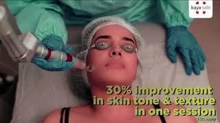 Get Rid of Pigmentation, Uneven Skin Tone & Texture | Kaya Insta Clarity Laser