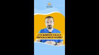 CVS Koryon Villus Örneklemesi Nedir? | Prof. Dr. Ali Ekiz #cvs