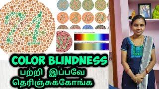 Color Blindness Problem In Tamil|| 3RosesLifeStyle