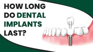 How Long Do Dental Implants Last?