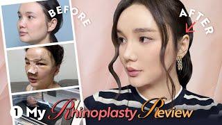 Celebrity from Mongolia came to NANA. Excited what she has done? | Mongolia Celeb Before and After