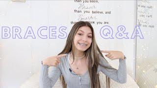 BRACES Q&A: teeth extraction, pain, q&a + more!