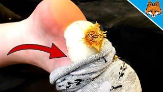 SOMETHING AMAZING happens, when you put an ONION in your SOCK 