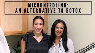 Microneedling: An alternative to BOTOX |  Edna & Alexandria