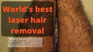 World's best hair removal laser