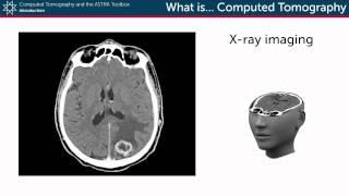 What is Computed Tomography?