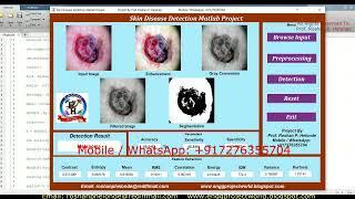 Skin Disease Detection Using Image Processing Code | Skin Disease Detection Using Matlab Source Code