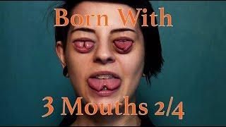 Born With Three Mouths 2/4 - Girl With Split Tongue