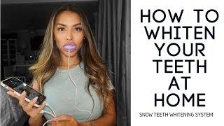 How to Whiten Your Teeth At Home (Snow Teeth Whitening System Review)