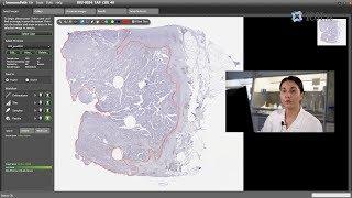 ImmunoPath - Automatic detection and scoring of immunohistochemistry