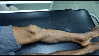 myoclonic jerk|Dr Bhupendra Shah|medicine classroom