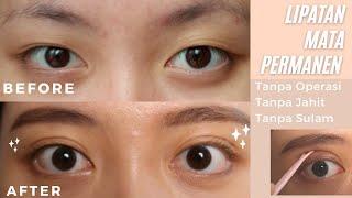 Cara Membuat Lipatan Mata PERMANEN tanpa Operasi  | Double Eyelid without Surgery