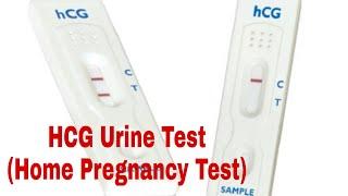 Home pregnancy test using HCG Urine Test Kit (Positive Test)