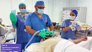 Video of DAS guidelines for the management of unanticipated difficult intubation in adults