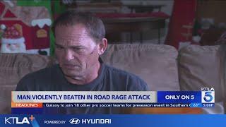 Man violently attacked by road rage driver in San Bernardino County