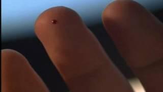 Microchip Implants: Where you can stick them! Verichip Mark of the Beasts