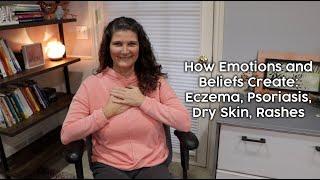 How Emotions and Beliefs Create: Eczema, Psoriasis, Dry Skin, Rashes