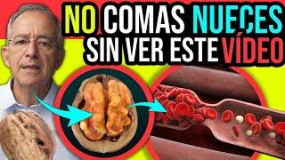 DESCUBRE Los SORPRENDENTES BENEFICIOS De Las NUECES Para Tu SALUD - Oswaldo Restrepo RSC