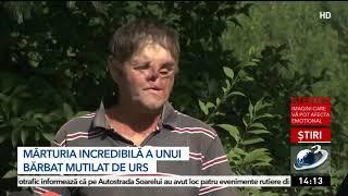 Povestea unui tânăr mutilat de urs, operat în spitale din trei țări: M-a mușcat de față