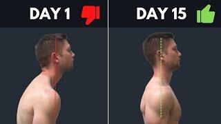 SUPER SIMPLE & Effective Fix For Rounded Shoulders & Forward Head Posture