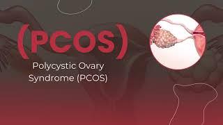 PCOS awareness