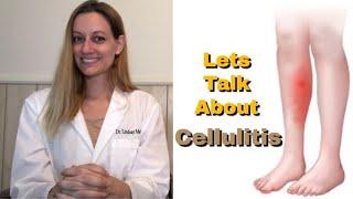 CELLULITIS: Everything You Need To Know! Symptoms. Cause. Risk Factors. Treatment. Prevention.