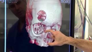 Surgical Theater: 3D Intra-Operative Navigation Technology