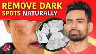 How to Remove Dark Spots and Get Clear Skin? (Pigmentation, Dark Underarms, Acne scars & more)