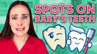 What Are Spots on Baby's Teeth?