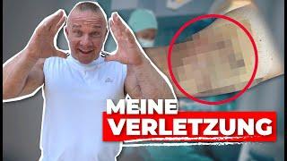 DER BODYBUILDER ARZT DOC RITSCH (Mein Quad-RISS) | Ronny Rockel