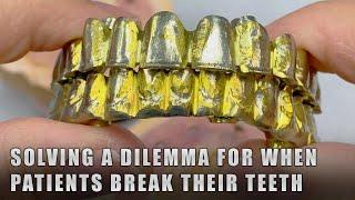 Solving a Dilemma for when Patients break their Teeth