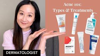 Acne 101: review and treatment tips from a dermatologist | Dr. Jenny Liu