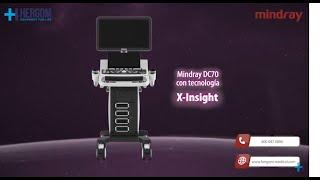 Mindray DC70 con X-Insight