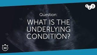 60 Seconds of Echo Teaching Question: What is the underlying condition?